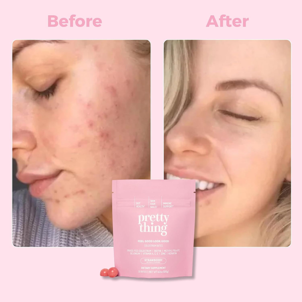 Pretty Thing Colostrum Bites for Women's – – Immune and Gut Health: Colostrum is rich in immunoglobulins and – Image 5
