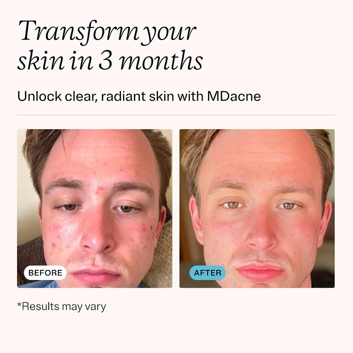 MDacne Vitamins and Minerals Skin Clearing – Individuals who prefer a simple, once-daily capsule rather than – Image 3