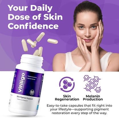 AURA VITAMINS Vitiligo Capsules - Skin Pigmentation Support - 60 Capsules