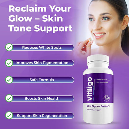AURA VITAMINS Vitiligo Capsules - Skin Pigmentation Support - 60 Capsules