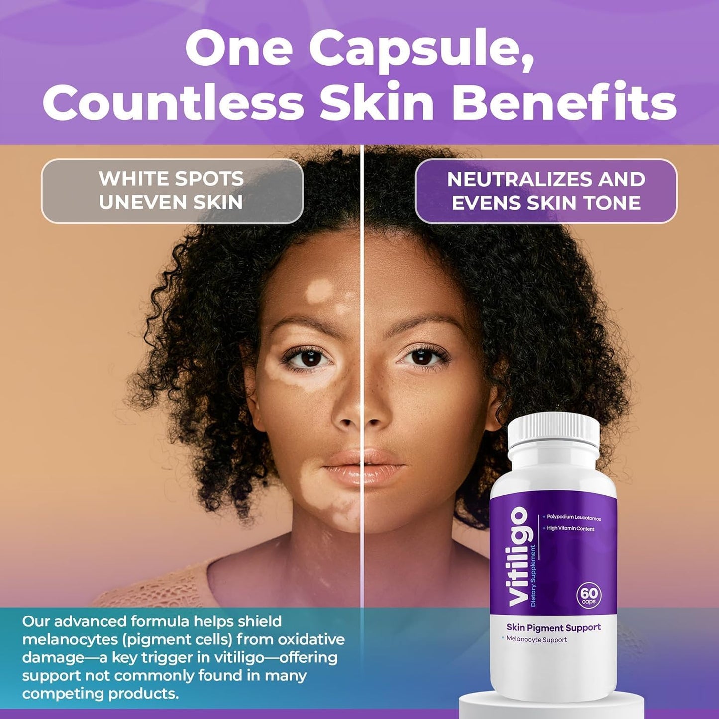 AURA VITAMINS Vitiligo Capsules - Skin Pigmentation Support - 60 Capsules - görsel 6